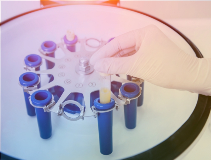 Platelet-Rich Plasma (PRP) Therapy